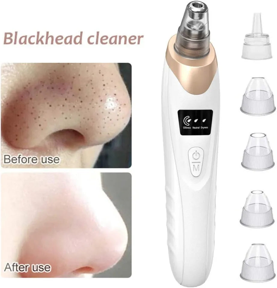 5 In 1 Blackhead Remover Machine Rechargeable Pore Cleaner - Skincare Device Designed For Pore Cleansing And Daily Beauty Routine